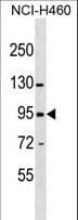 ZNF484 Antibody (aa100-127)