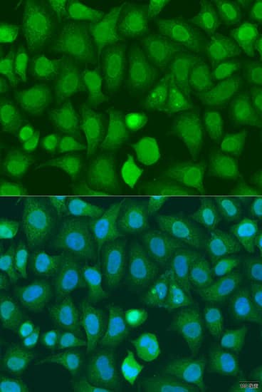 CHD1 Antibody