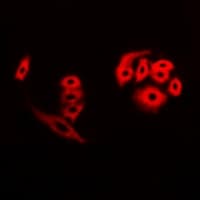 CFHR3 / CFHL3 Antibody