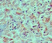 Polyclonal Rabbit anti-Human EPCAM Antibody (aa275-325, IHC, WB)