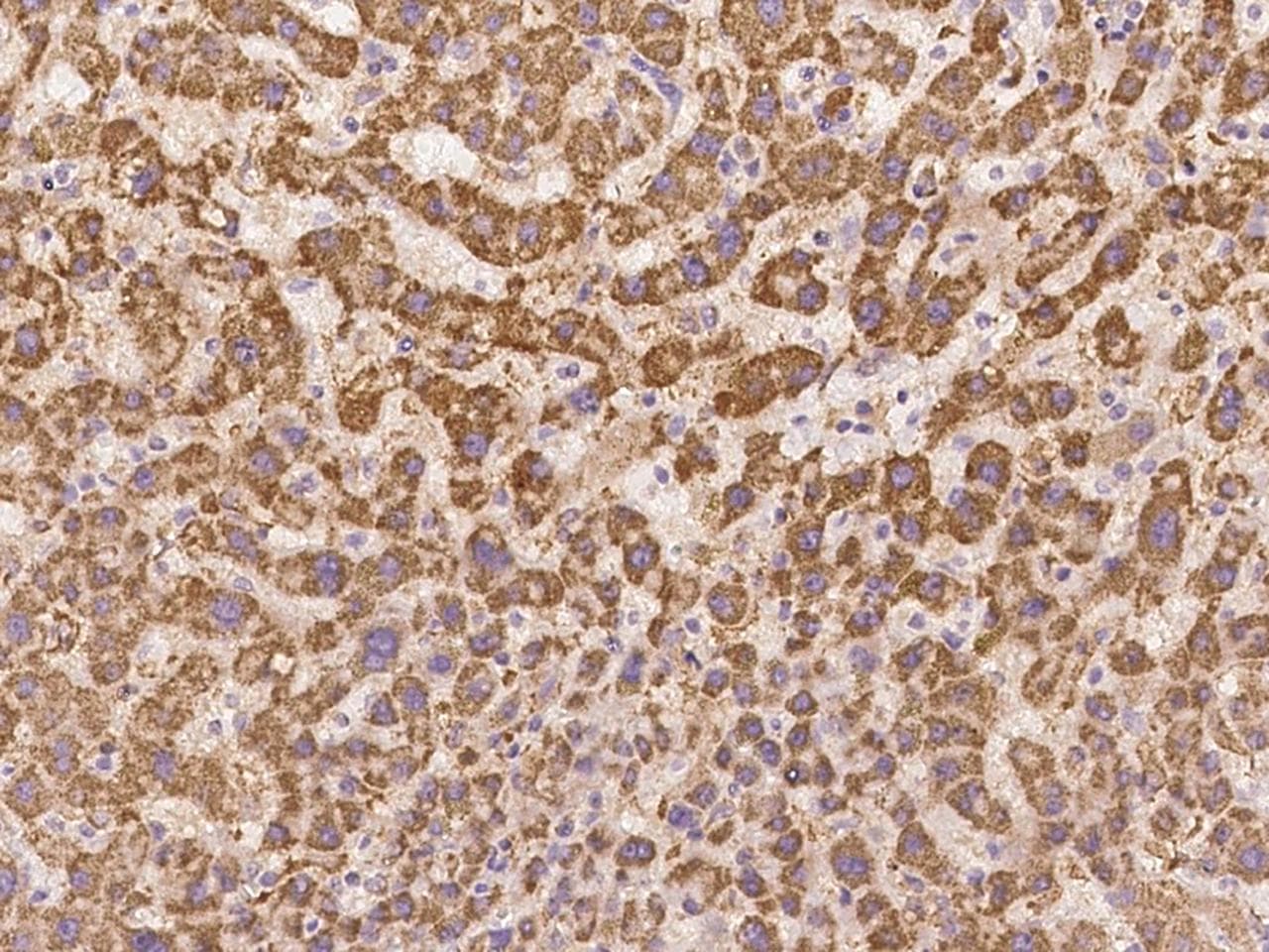 ZNF354C Antibody