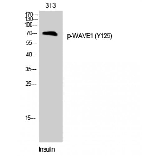 Polyclonal Rabbit anti-Human WASF1 / WAVE Antibody (60-140 aa, IHC, IF, WB)
