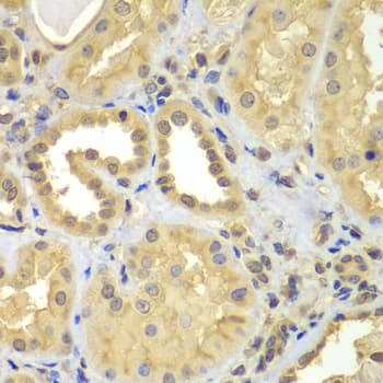 Polyclonal Rabbit anti-Human CIAO1 Antibody (IHC, WB)