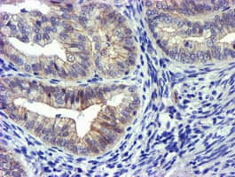 GSTO2 Antibody (clone OTI2A12)