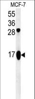 ATP5J2 / F1Fo-ATPase Antibody (aa18-46)