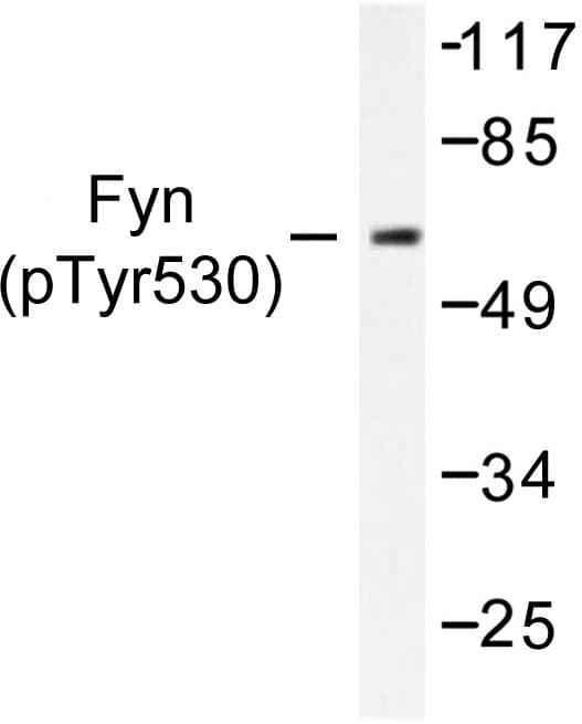 SYN / FYN Antibody (phospho-Tyr530)