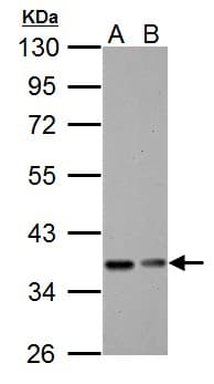 NFKBIA / IKB Alpha / IKBA Antibody (aa1-317)