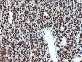Monoclonal Mouse anti-Human Mannose Phosphate Isomerase Antibody (clone OTI1C7, Carrier-free, IHC, IF, WB)