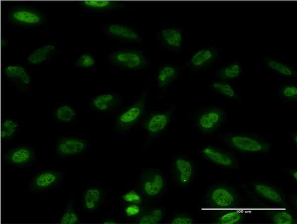 EIF4EBP1 / 4EBP1 Antibody (clone 4F3-H2)