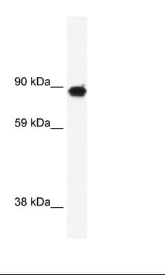 GRM6 / MGLUR6 Antibody (aa700-749)