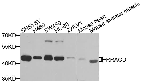 Polyclonal Rabbit anti-Human RRAGD Antibody (WB)