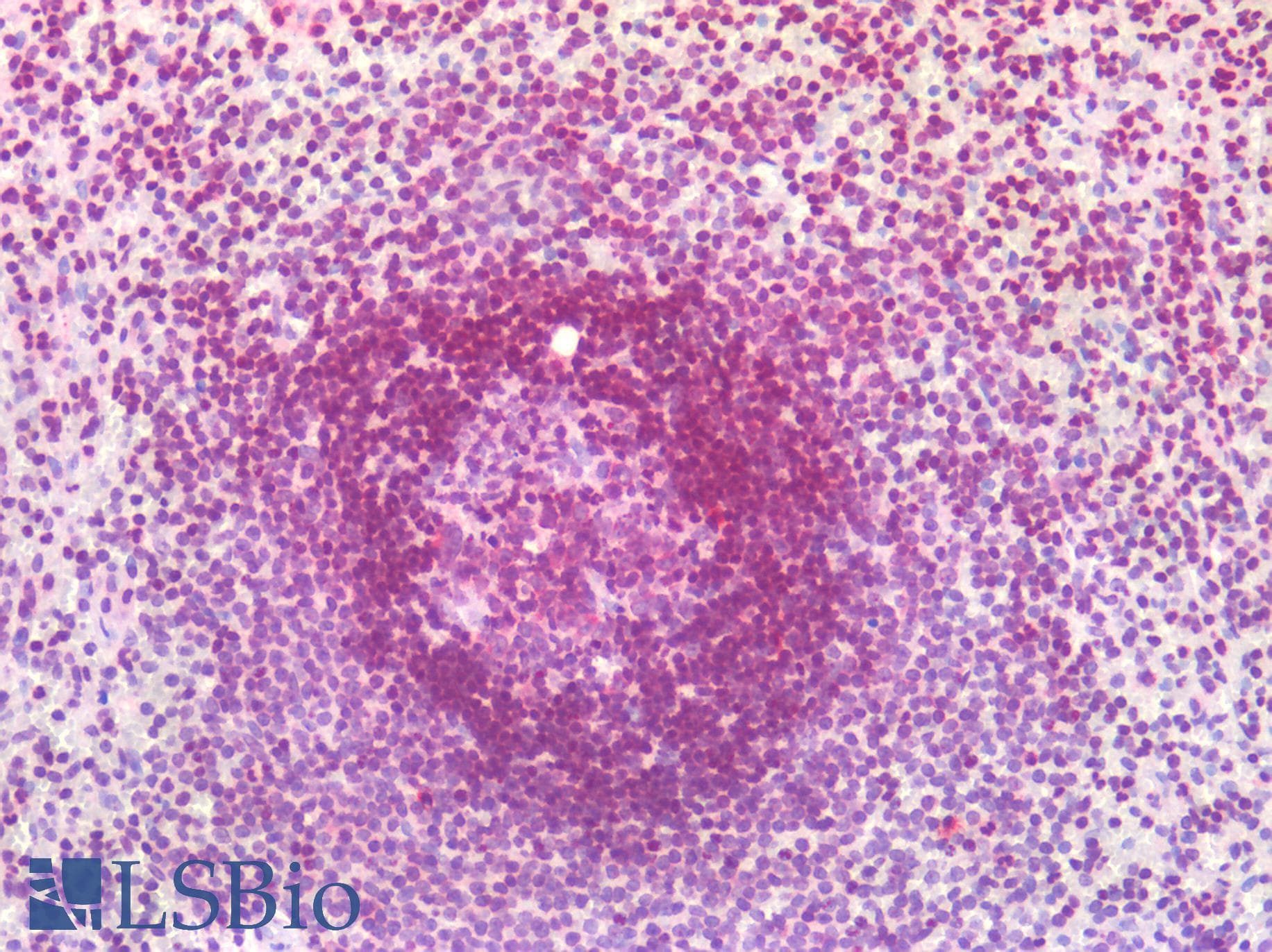 PathPlus™ Polyclonal Rabbit anti-Human SMN1 Antibody (aa45-94, IHC, WB)