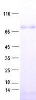 Human ZNF652 Protein (Recombinant His, N-Terminal)