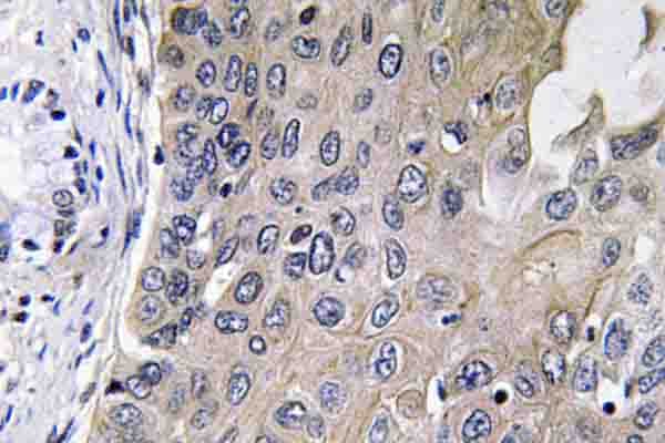 GUCY1A1 / GUCY1A3 Antibody (Asp423)