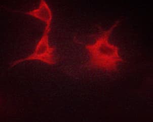 ADRB2 Antibody (phospho-Ser346)