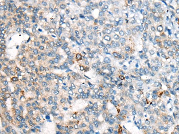 Polyclonal Rabbit anti-Human CES2 / Esterase Antibody (IHC, WB)