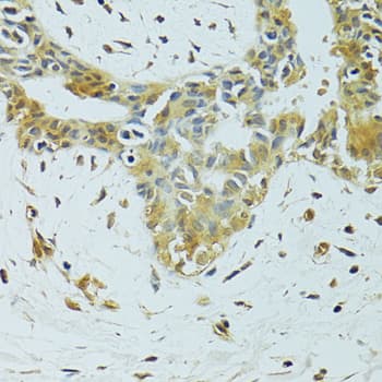 METTL13 / KIAA0859 Antibody