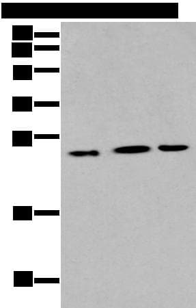 IL6 / Interleukin 6 Antibody