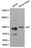 AR / Androgen Receptor Antibody