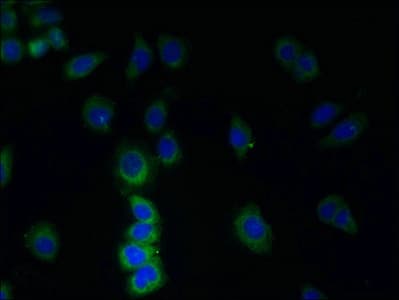 TMEM38B Antibody