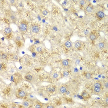 Polyclonal Rabbit anti-Human CALD1 / Caldesmon Antibody (IHC, IF, WB)