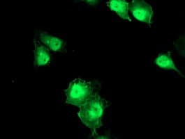 ERCC1 Antibody (clone OTI3B1)