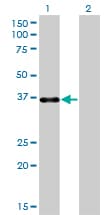 Monoclonal Mouse anti-Human PITX1 Antibody (clone 5G4, WB)