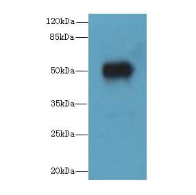 ALS2CR15 / ICA1L Antibody