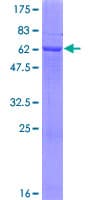 Human LDHC / Lactate Dehydrogenase C Protein (Recombinant GST)
