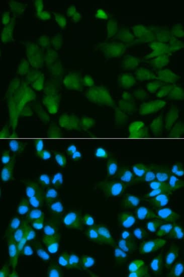 PHPT1 Antibody