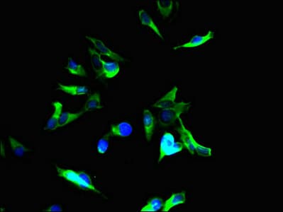 Polyclonal Rabbit anti-Human Tuberin / TSC2 Antibody (IF, WB)