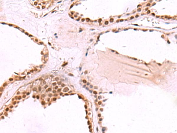 TIP49 / RUVBL1 Antibody
