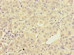 Polyclonal Rabbit anti-Human TRAF2 Antibody (IHC, IF)