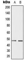 CCNE1 / Cyclin E1 Antibody (phospho-Thr395)