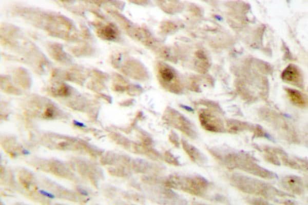 CBFB Antibody (Arg33)