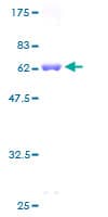 Human RBKS / Ribokinase Protein (Recombinant GST)