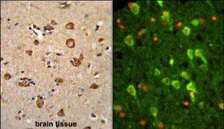 ANXA7 / Annexin VII / SNX Antibody (aa 329-356, Internal)