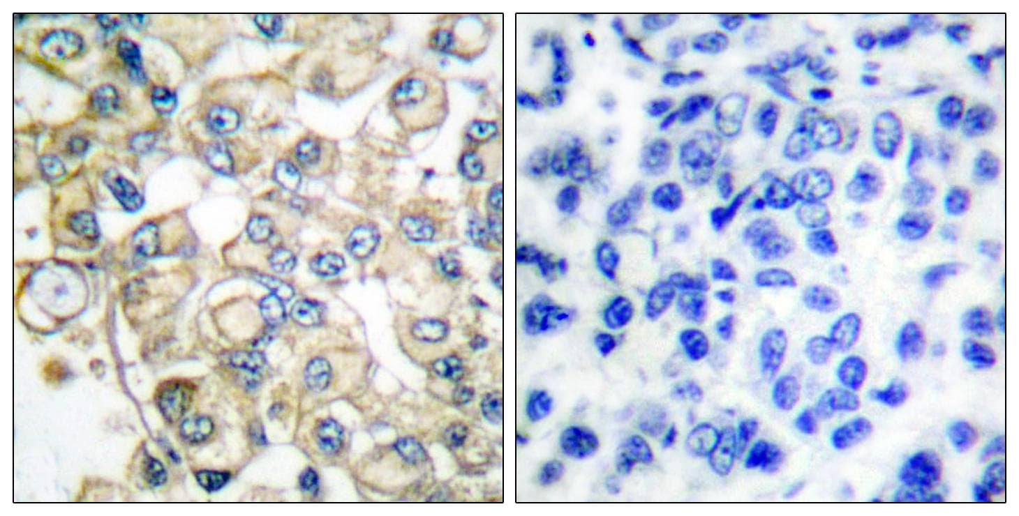 Polyclonal Rabbit anti-Human FGFR1OP / FOP Antibody (IHC, WB)