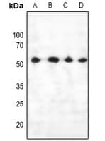Polyclonal Rabbit anti-Human PTEN Antibody (IHC, WB)