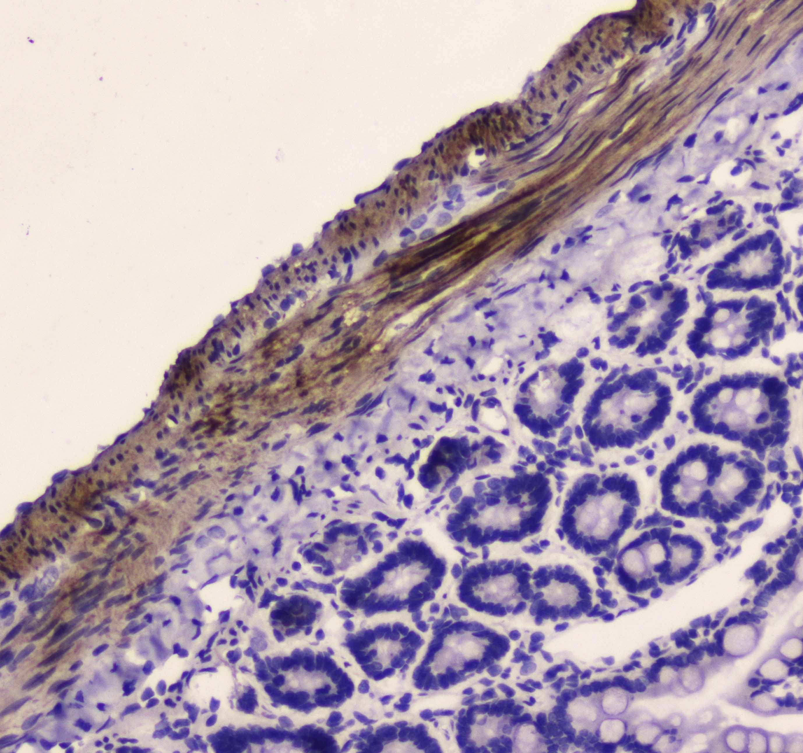 MYLK Antibody