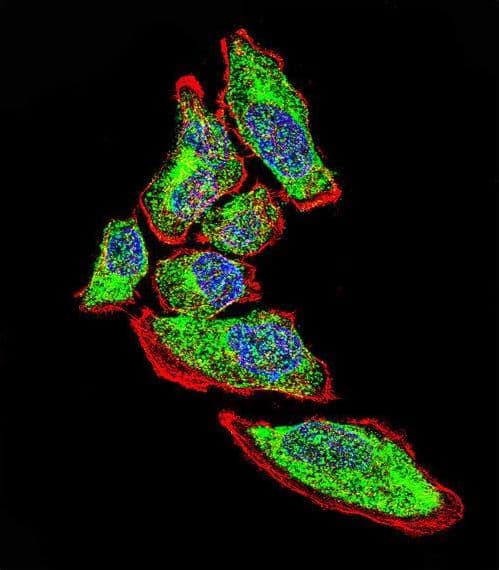 IHC-plus™ Polyclonal Rabbit anti-Human Vimentin Antibody (IHC, IF, WB)