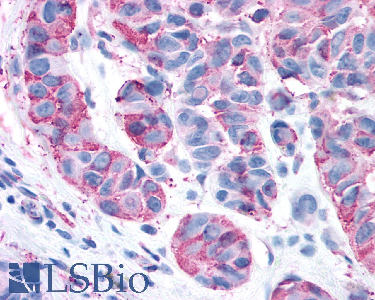 IHC-plus™ Polyclonal Rabbit anti-Human GPRC5A / RAI3 Antibody (Cytoplasmic Domain, IHC)