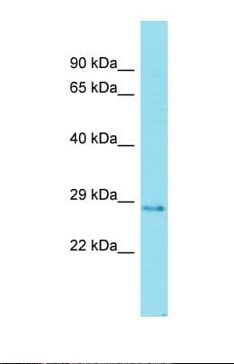 Polyclonal Rabbit anti-Human FAM192A / Nip30 Antibody (aa139-188, WB)