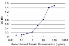 KHSRP / FBP2 Antibody (clone 4H7)