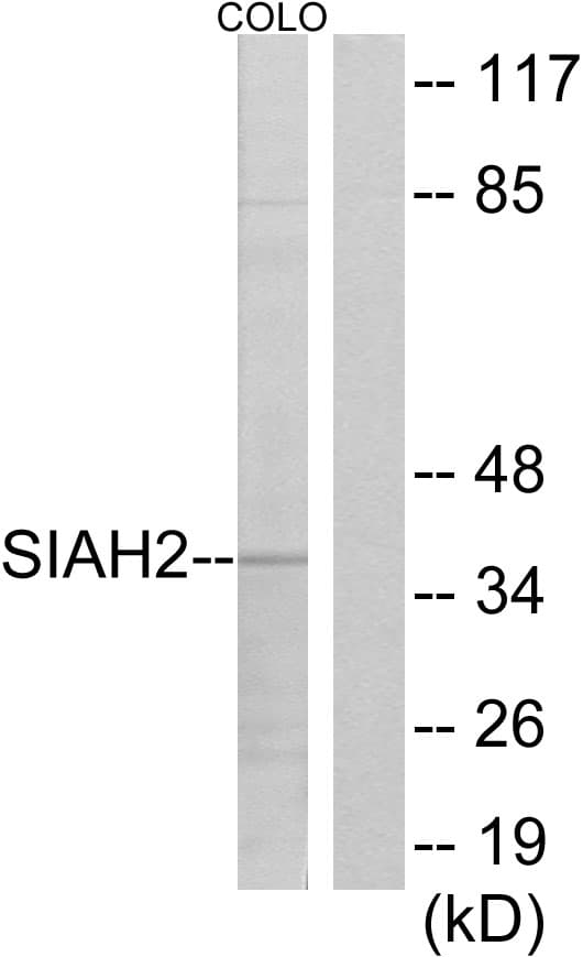 SIAH2 Antibody (aa241-290)
