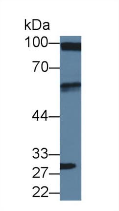 DBN1 / Drebrin Antibody (aa3-134, PE)