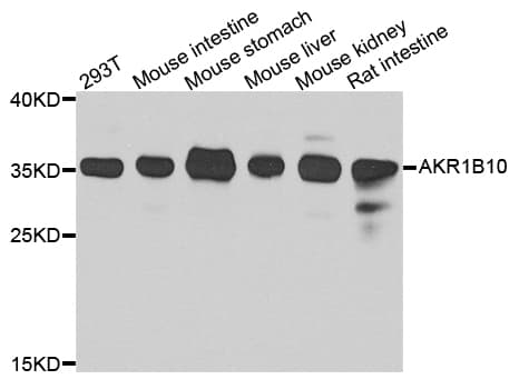 Polyclonal Rabbit anti-Human AKR1B10 Antibody (IHC, WB)