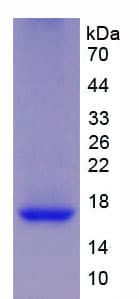 Human REG1B Protein (Recombinant His-T7)