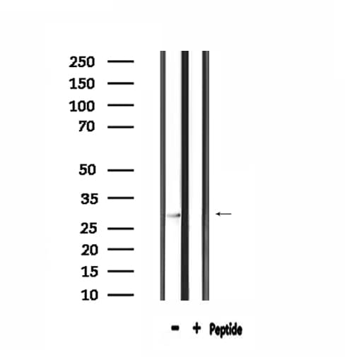SPIC Antibody