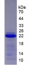Human SERPINB4 / SCCA1+2 Protein (Recombinant His, N-Terminal)